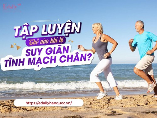 Bị Bệnh Suy Giãn Tĩnh Mạch Chân Thì Tập Luyện Thế Nào?