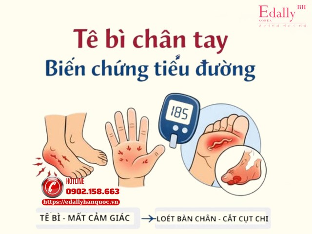 Tê bì chân tay - Coi chừng biến chứng bệnh tiểu đường