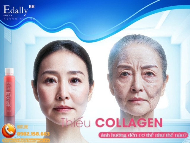 Thiếu hụt collagen ảnh hưởng đến cơ thể như thế nào?