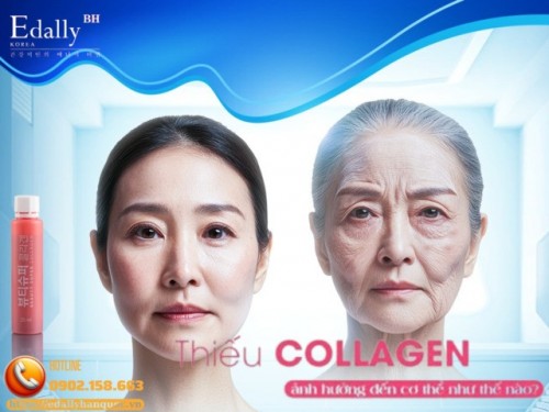 Giá Trị Thật Của Collagen Đối Với Cơ Thể