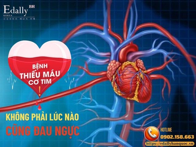 Thiếu máu cơ tim - Không phải lúc nào cũng đau ngực
