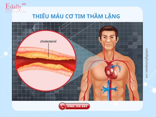 Thiếu Máu Cơ Tim Thầm Lặng Và Nguy Cơ Nhồi Máu Cơ Tim