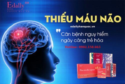 Bệnh Thiếu Máu Não - Đừng Chủ Quan