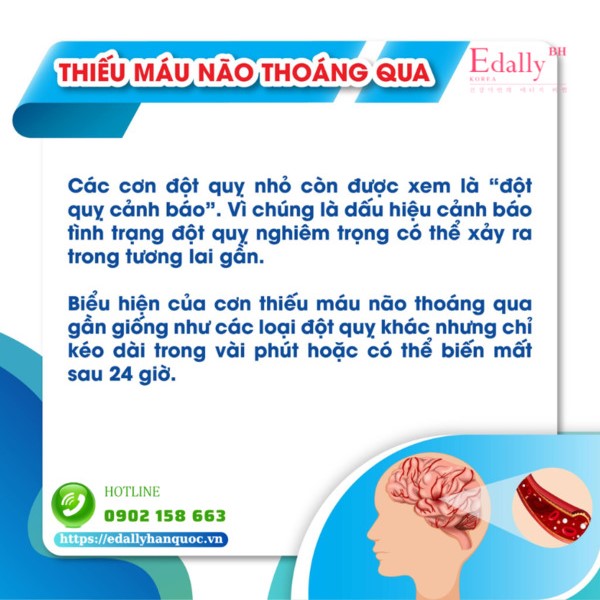 Thiếu máu não thoáng qua (đột quỵ nhỏ)