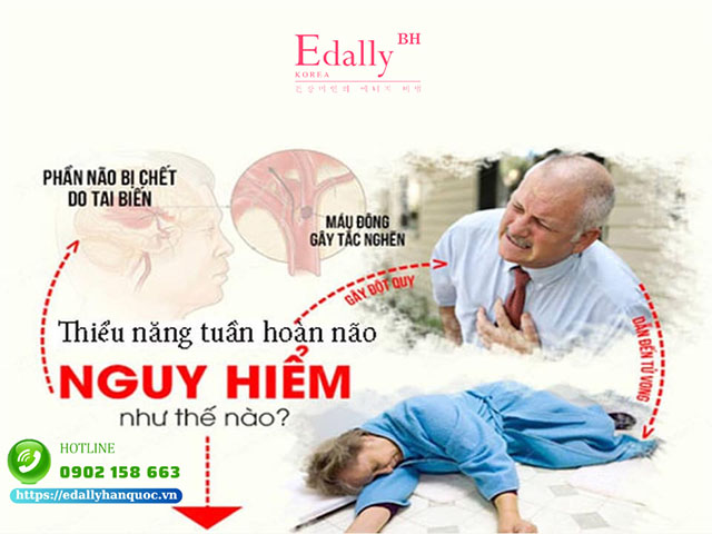 Thiểu Năng Tuần Hoàn Não Có Nguy Hiểm Không?