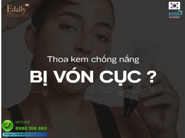 Thoa kem chống nắng bị vón cục - Nguyên nhân và cách khắc phục hiệu quả