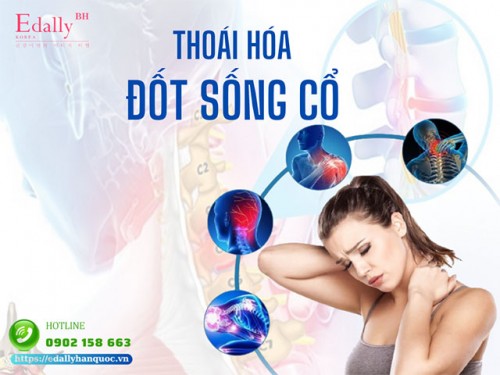 Thoái Hóa Đốt Sống Cổ: Nguyên Nhân, Triệu Chứng Và Cách Điều Trị