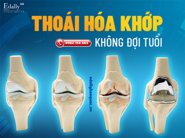 Thoái hóa khớp là că bệnh nguy hiểm không đợt tuổi nên chúng ta cần lưu ý để phòng tránh