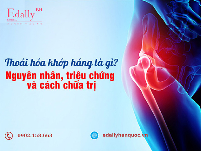 Bệnh thoái hóa khớp háng là gì? Nguyên nhân, triệu chứng và cách điều trị