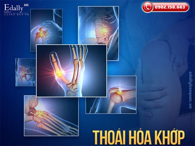 Thoái hóa khớp là bệnh lý cơ xương khớp có biến chứng nguy hiểm hàng đầu dẫn đến tàn phế