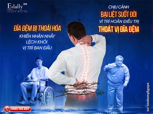 Bệnh thoát vị đĩa đệm có nguy hiểm không?