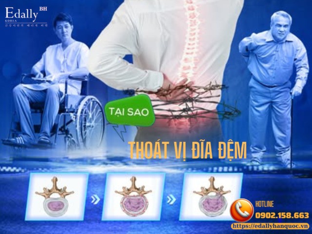 Thoát Vị Đĩa Đệm: Nguyên Nhân, Mức Độ Bệnh Và Thái Độ Xử Trí