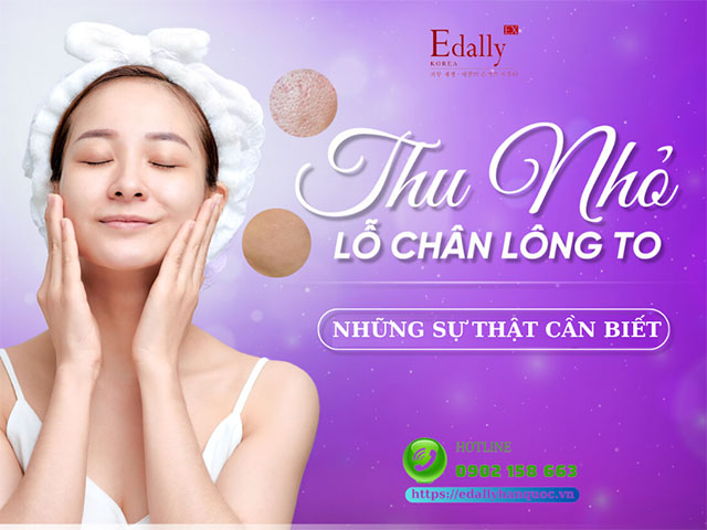 Điều trị thu nhỏ lỗ chân lông to và những điều cần phải biết