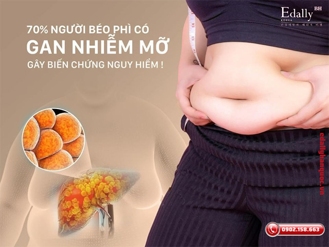 Thừa cân béo phì làm tăng nguy cơ mắc bệnh gan nhiễm mỡ