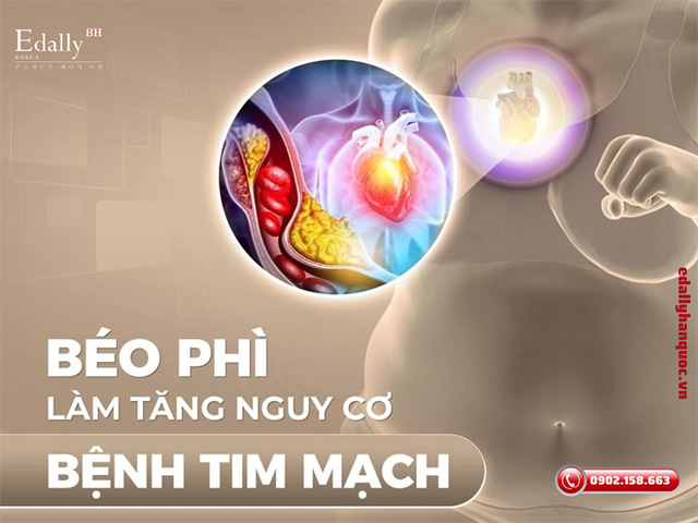 Thừa cân béo phì làm tăng nguy cơ mắc bệnh tim mạch