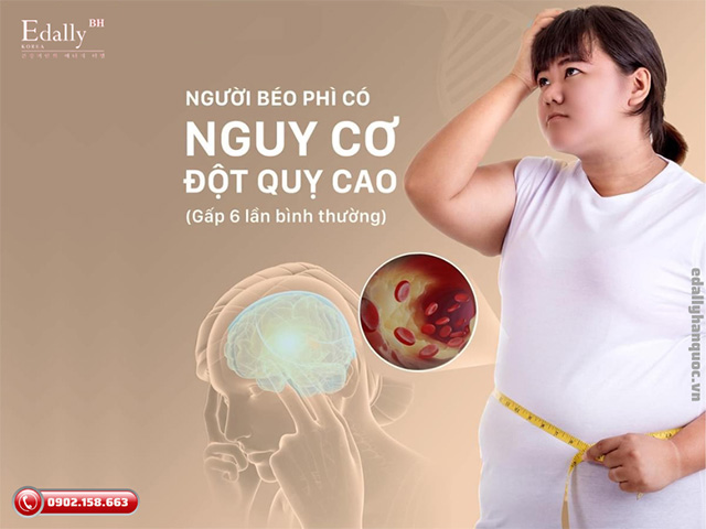 Thừa cân béo phì làm tăng nguy cơ đột quỵ cao gấp 6 lần so với người bình thường