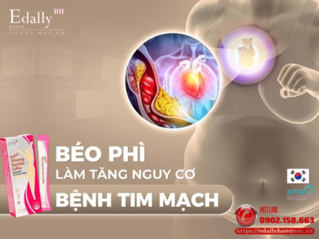 Thừa cân, béo phì làm tăng nguy cơ mắc các bệnh về tim mạch