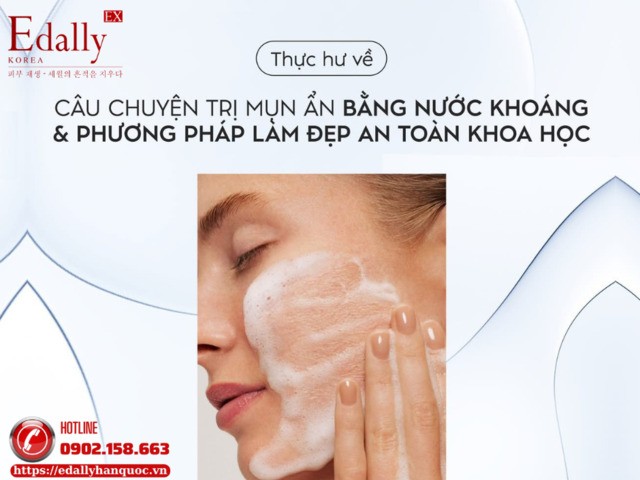 Thực Hư Về Câu Chuyện Trị Mụn Ẩn Bằng Nước Khoáng Và Phương Pháp Làm Đẹp An Toàn Khoa Học