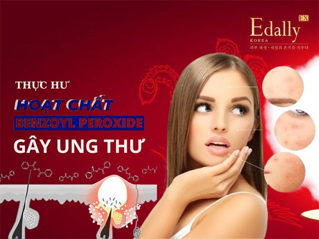 Thực hư câu chuyện các sản phẩm chứa Benzoyl Peroxide điều trị mụn gây ung thư - Gieo rắc nỗi sợ fearmongering hay chỉ đơn giản là câu chuyện bảo quản sản phẩm?