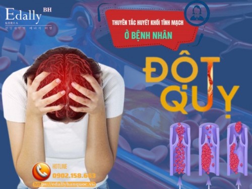 Thuyên Tắc Huyết Khối Tĩnh Mạch Ở Bệnh Nhân Đột Quỵ Não - Nguyên Nhân Gây Tử Vong Cần Được Quan Tâm