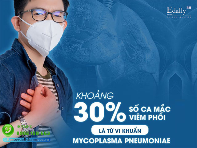Khoảng 30% mắc biêm phổi là do vi khuẩn Mycoplasma gây ra