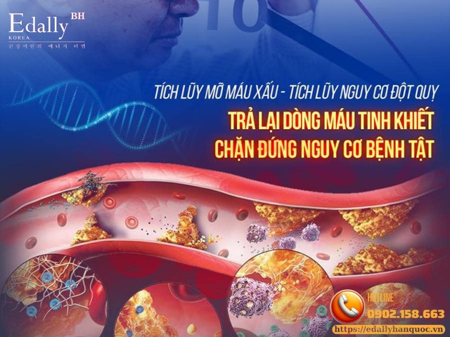 Tích lũy mỡ máu xấu ở bệnh tim mạch do xơ vữa (ASCVD) là tích lũy nguy cơ đột quỵ và nhồi máu cơ tim