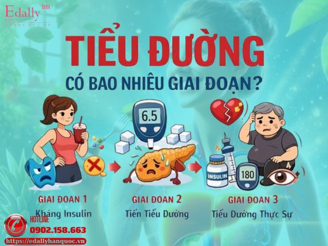 Các giai đoạn tiến triển của bệnh tiểu đường Các giai đoạn tiến triển của bệnh tiểu đường