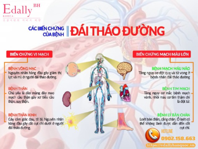 Bệnh tiểu đường không kiểm soát = biến chứng mạn tính rình rập cả đời