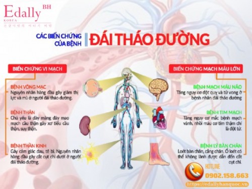 Tiểu Đường Không Kiểm Soát = Biến Chứng Mạn Tính Rình Rập Cả Đời