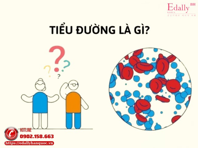 Tiểu đường là gì và làm sao để quản lý bệnh hiệu quả, không gây biến chứng?
