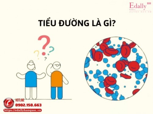 Tiểu Đường Là Gì Và Làm Sao Để Quản Lý Bệnh Hiệu Quả?