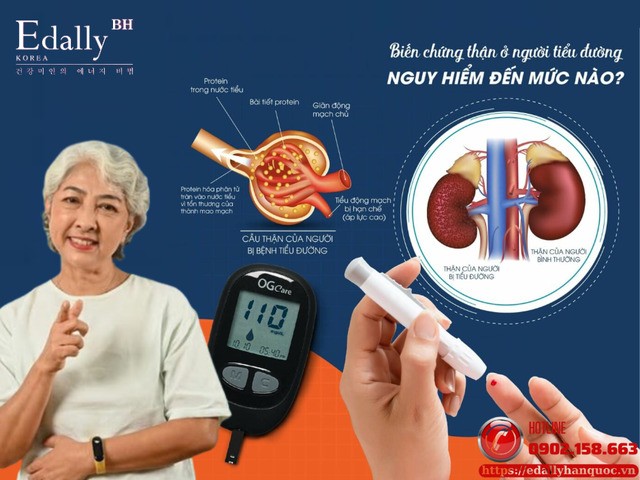 Tiểu đường và thận: Sự tàn phá âm thầm ít ai nhận ra