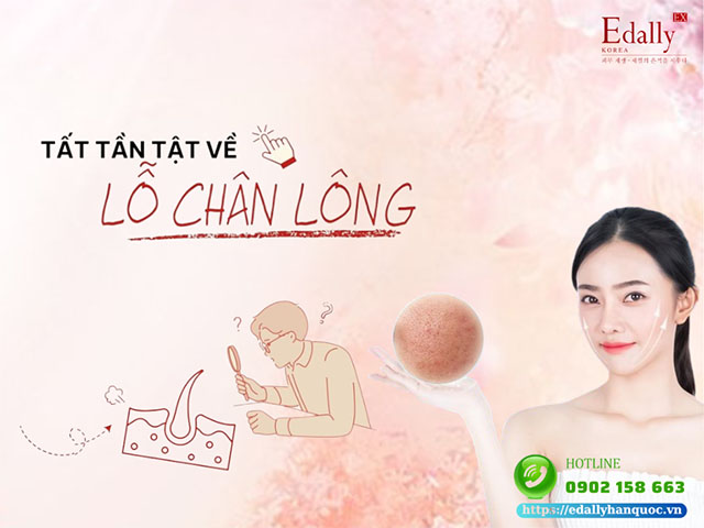 Tìm hiểu về lỗ chân lông to và cách để thu nhỏ lỗ chân lông