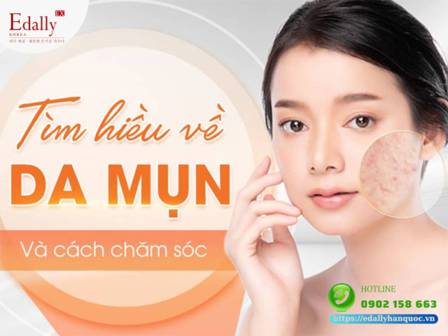 Tìm hiểu về mụn trứng cá