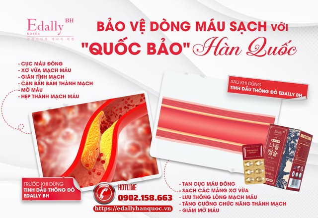 Tinh dầu thông đỏ Hàn Quốc Edally Pine Needle Capsule - Bí quyết phòng ngừa và đẩy lùi xơ vữa động mạch