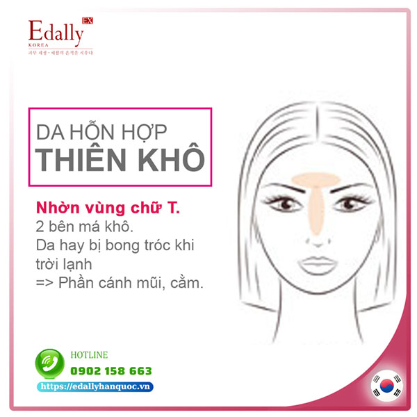 Type da hỗn hợp thiên khô và cách chăm sóc da hiệu quả