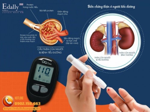 Có Phải Tổn Thương Thận Ở Bệnh Nhân Đái Tháo Đường (ĐTĐ) Là Biến Chứng Do Đái Tháo Đường Gây Nên Không?