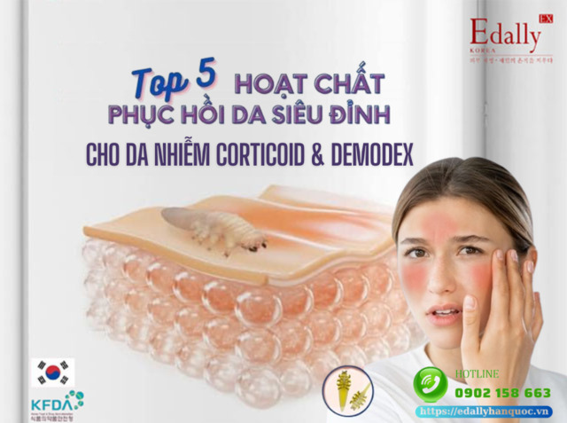 Top 5 hoạt chất phục hồi da siêu đỉnh cho da tổn thương do Corticoid và Demodex