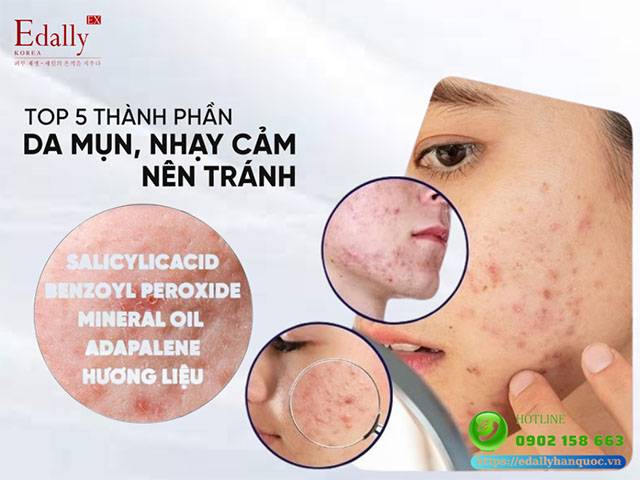 Top 5 thành phần trong mỹ phẩm làm da mụn nhạy cảm trở nên tồi tệ hơn