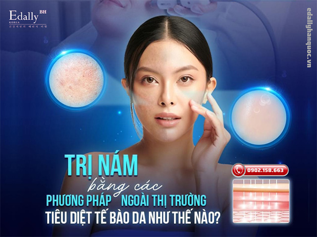 Trị nám bằng các phương pháp ngoài thị trường tiêu diệt tế bào da như thế nào?