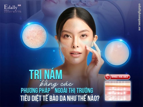 Trị Nám Bằng Các Phương Pháp Ngoài Thị Trường Tiêu Diệt Tế Bào Da Như Thế Nào?