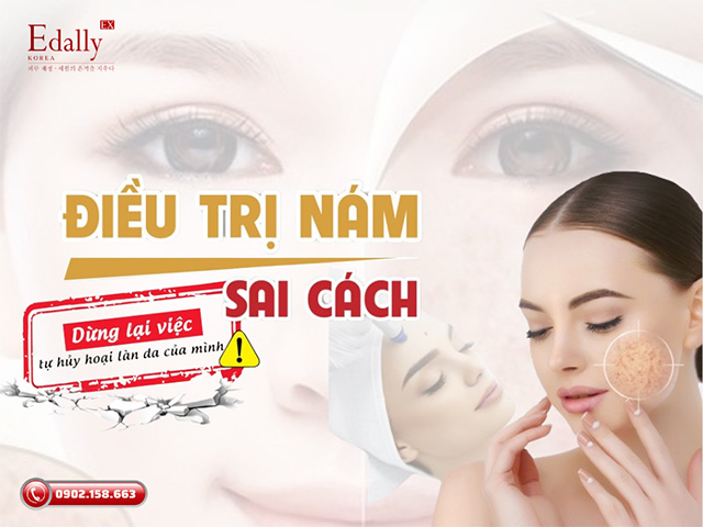 Điều trị nám da không đúng cách - Hãy dừng lại việc tự hủy hoại làn da của mình