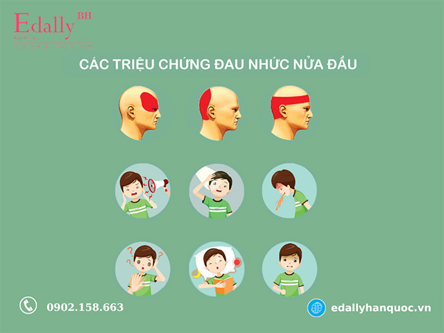 Triệu chứng của bệnh đau nửa đầu Migraine