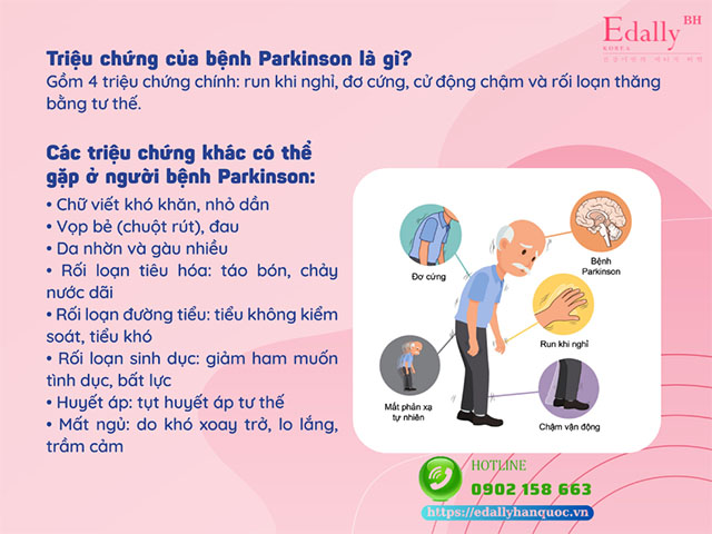 Dấu hiệu nhận biết bệnh Parkinson là gì?