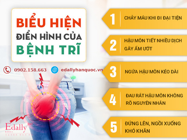 Triệu chứng của bệnh trĩ