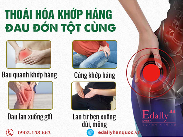 Các dấu hiệu của bệnh thoái hóa khớp háng