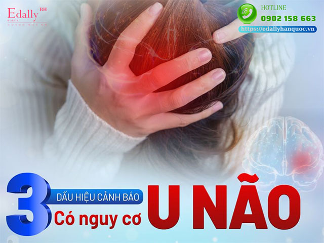 3 dấu hiệu cảnh báo có nguy cơ u não nguyên phát