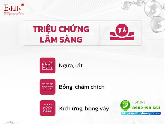 Triệu chứng lâm sàng của làn da nhạy cảm