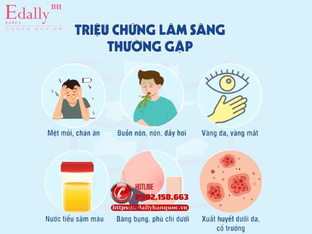 Dấu hiệu lâm sàng thường gặp của bệnh lý gan mật
