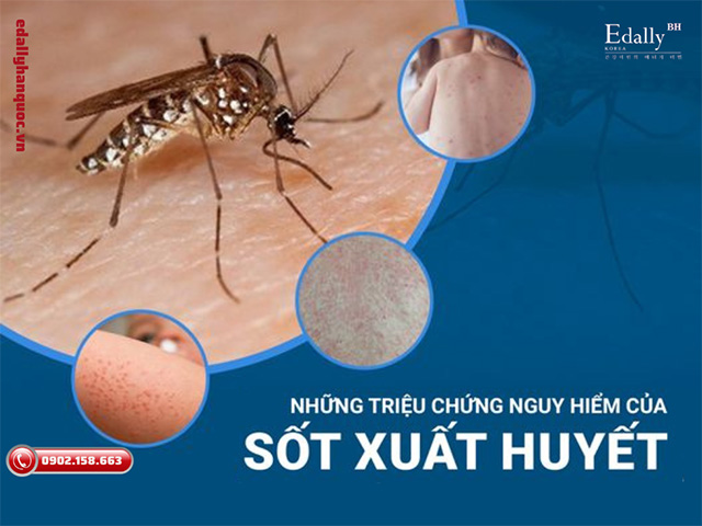 Những triệu chứng nguy hiểm của sốt xuất huyết Dengue